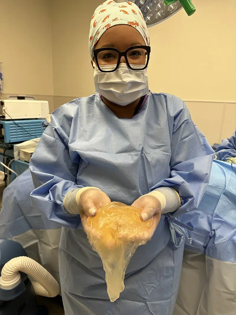 Dr. Aisha White holding a textured silicone breast implant in an operating room.